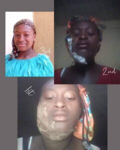 Testimony of Longrich Panty liner treating a dental abscess in Cameroon 