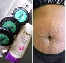 Fast acting products for stretch marks